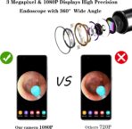 Bebird R1 Ear Cleaner Wax Intelligent Ear Wax Removal Tool Camera Endoscope - Image 7