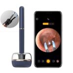 BeBird Note 3 Pro Robotic Smart Visual Ear Cleaning Endoscope Tweezers with Camera 10 MP HD for SmartPhone
