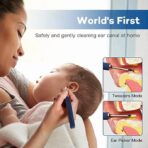 BeBird Note 3 Pro Robotic Smart Visual Ear Cleaning Endoscope Tweezers with Camera 10 MP HD for SmartPhone - Image 5