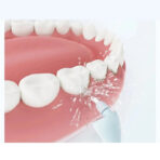 Xiaomi SUNUO Smart Visual Teeth Water Flosser 500W (C3 Pro) - Image 6