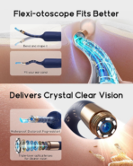 Bebird EarSight Plus (D39R)